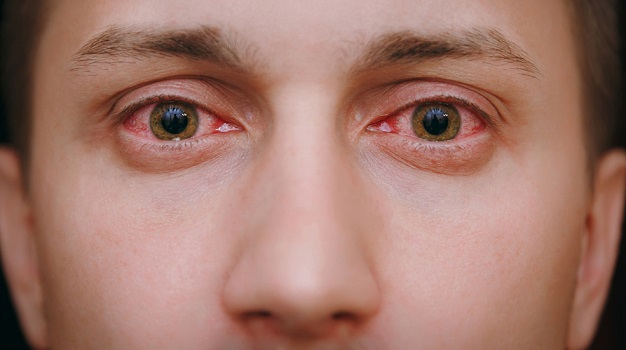 болезни глаз