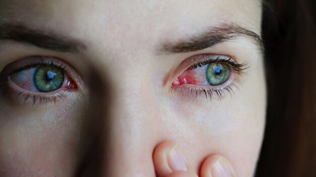 Воспаление глаз